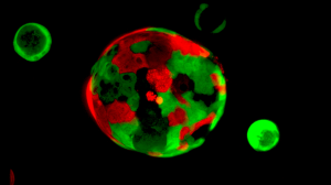Rita Allen Foundation Scholar David Tuveson and his team have developed an “organoid” system for growing pancreatic tissue in three-dimensional culture. Organoids consisting of normal cells (red) and cancer cells (green) are cultured together to identify therapies that selectively target cancer cells. (Image: Tuveson Lab/CSHL)