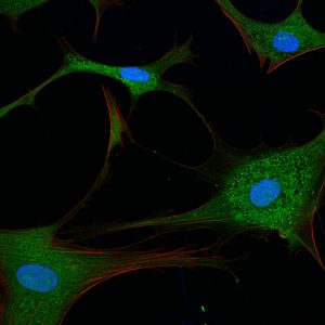 Rita Allen Foundation Scholar Hilary Coller uses fibroblasts, cells that form connective tissue in animals, to study cell quiescence, in which cells reversibly exit the cell cycle. Shown here are primary human fibroblasts visualized with fluorescent stains. (Image: Sarah Pfau)