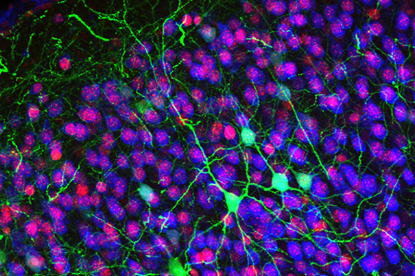 Rita Allen Foundation Scholar Jeffrey Macklis studies the development of the cerebral cortex, the most complex, outer layers of the brain critical for voluntary movement, sensation, thinking, memory, language and consciousness. Shown here are callosal projection neurons (green), which connect the two hemispheres of the cerebral cortex and are known to develop abnormally in some cognitive disorders. (Image: Jessica MacDonald and Jeffrey Macklis)