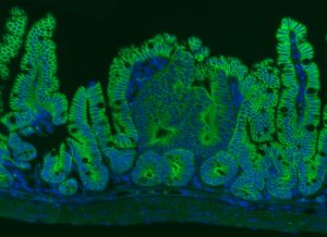 Rita Allen Foundation Scholar Joshua Mendell has studied the involvement of microRNAs in cancer. His lab found that a microRNA called miR-26 could suppress the formation of intestinal tumors—shown here in a mouse model. Intestinal epithelial cells are labeled in green, and cell nuclei are labeled in blue. (Image: Lauren Zeitels)