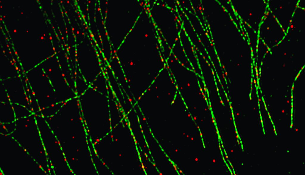 PTEN protein associates with cellular "roads" made up of microtubulues